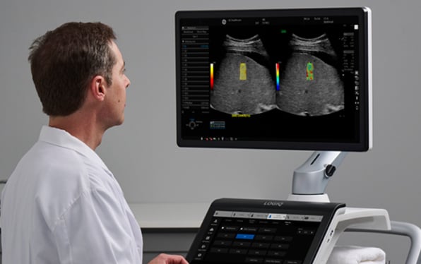 General Imaging | LOGIQ™