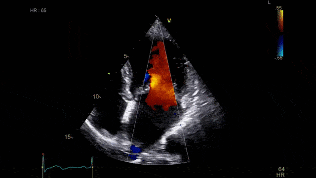 App image